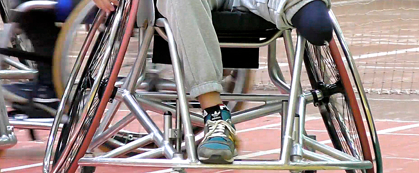 Инвалиды в Удмуртии получат протезы с интернет-чипами