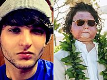 Американец, которому пересадили лицо и руки 47-летнего донора, счастлив в браке: фото