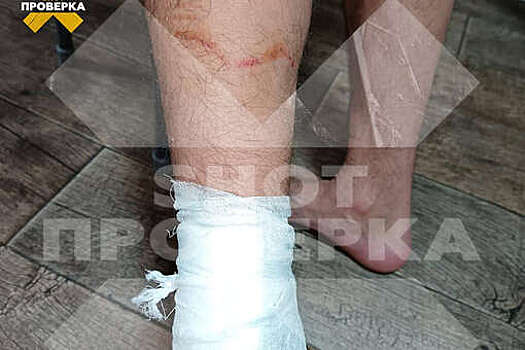 В Новосибирске 13 бродячих собак набросились на мусорщика и искусали его