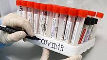В России зафиксировали 13 655 новых случаев коронавируса за прошедшую неделю