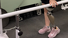 Юной спортсменке из Саратова, лишившейся ноги, изготовили протез. Девочка учится ходить на двух ногах