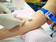 Врач: что делать, если в крови повышены жиры