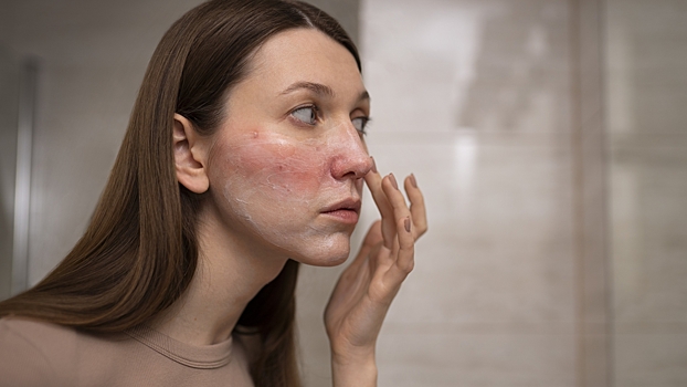 Врач объяснил, как защитить кожу от зимних повреждений