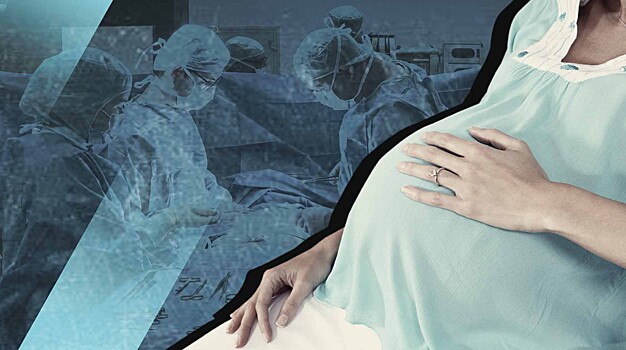 Закон есть, дел нет: почему в Твери не штрафуют за склонение к абортам