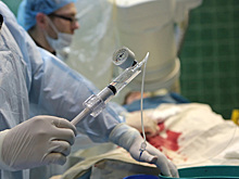 Мужчина на спор проглотил зажигалку и 35 лет проходил с ней в желудке