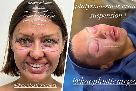 Хирург заявил, что Викторию Боню «развели» на $250 тысяч