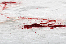 В Петрозаводске мужчина погиб от упавшего с крыши льда