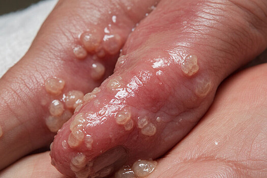 Учения по борьбе с ящуром в НАО: как предотвратить эпидемию