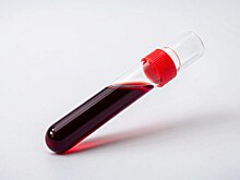 Обнаружена новая группа крови: женщина, которая может быть донором только для себя