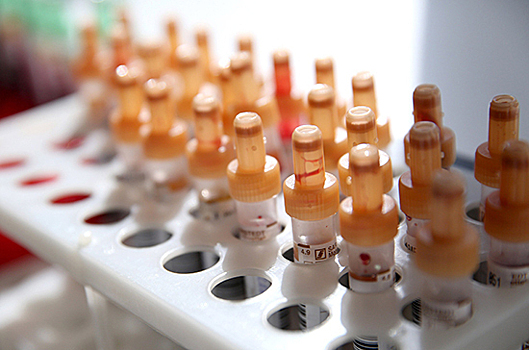 В Италии за сутки выявили более 24 тысяч новых случаев COVID-19