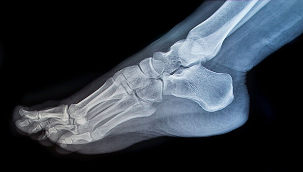 Рентгеновские снимки будет расшифровывать искусственный интеллект