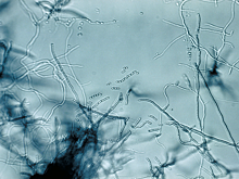 Нобелевские лауреаты: Зельман Ваксман. Антибиотики под ногами