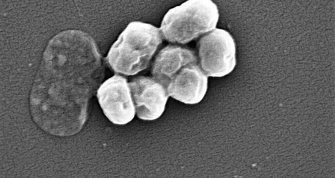 Бактериофаг смог убить одну из самых опасных супербактерий