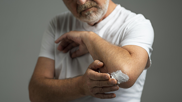 Псориаз: что скрывается за красными пятнами на коже