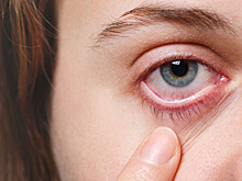 Не только переутомление: вот 5 причин, почему краснеют глаза