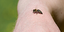 Что делать после укуса пчелы