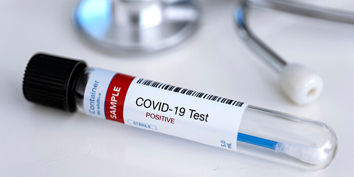 Ряд антикоронавирусных мер отменили в России с 17 июня