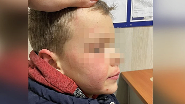Шестиклассники в Петербурге избили 11-летнего мальчика, он попал в больницу