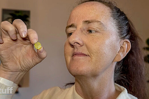 В Новой Зеландии врачи удалили из носа женщины игрушку, попавшую туда 37 лет назад