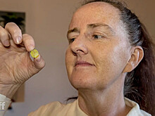 В Новой Зеландии врачи удалили из носа женщины игрушку, попавшую туда 37 лет назад
