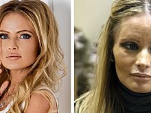 5 отечественных звезд, которые перестали за собой следить и запустили свою внешность