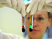 О донорстве костного мозга расскажут в инфографике