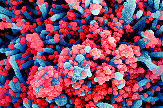 У коронавирусов нашли уязвимое место