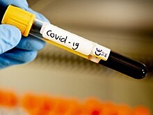 Оперативные данные по Covid-19 в Калужской области на 13 августа