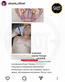 Семья Тимура Хайдарова прокомментировала судебный иск, поданный на жену хирурга: эксклюзив Super