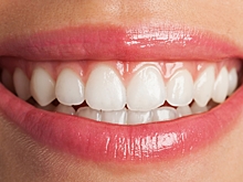 Разработан точный метод диагностики кариеса