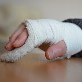 В Екатеринбурге школьница сломала руку на уроке физкультуры