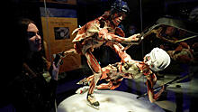 «Парад уродов»: директор Кунсткамеры оценил выставку мертвых тел