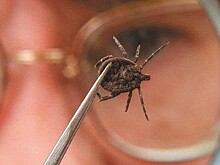 В Кировской области клещи покусали 4589 человек: есть случаи заражения энцефалитом