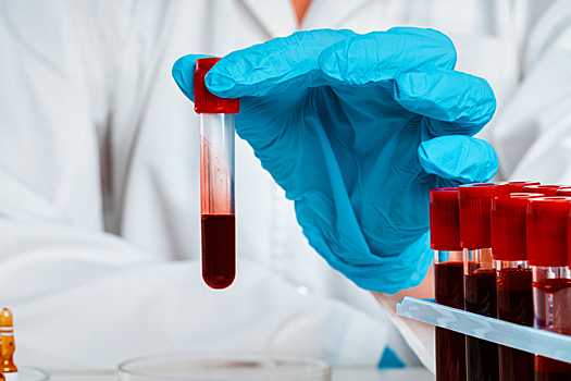 Как определить густоту крови и почему важно за этим следить