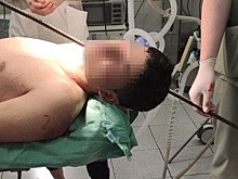 Полутораметровый кусок арматуры удалили из шеи жителя Подмосковья