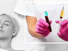 Натуральный биостимулятор из вашей крови: что такое PRF и какой он дает эффект