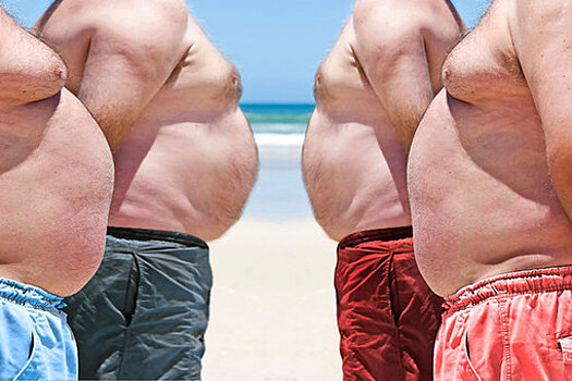BMJ Open: люди с ожирением 2-3 степени часто страдают от дефицита витамина D