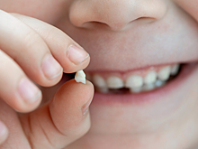 Когда ребенку нельзя вырывать молочный зуб