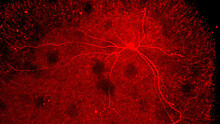 Помогут ли новые данные о двигательных нейронах справиться с неизлечимым недугом