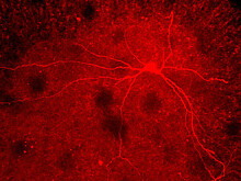 Помогут ли новые данные о двигательных нейронах справиться с неизлечимым недугом