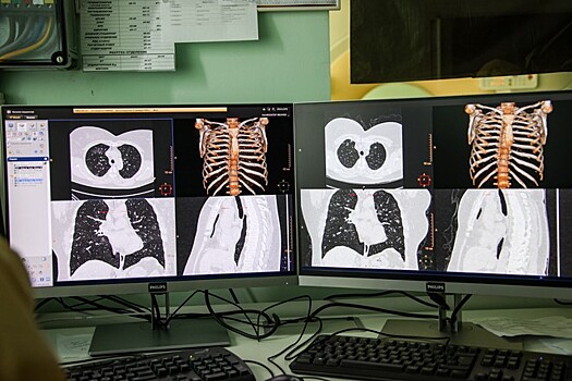 Учёные объяснили, как коронавирус поражает стенки сосудов