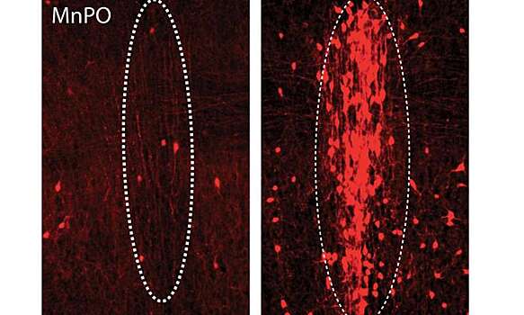 Найдены нейроны, отвечающие за жажду