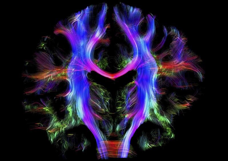 Нервные волокна в головном мозге взрослого здорового человка. Различные части мозга взаимодействуют друг с другом через эти нервные волокна, которые на фотографии отмечены цветной маркировкой. Волокна, связывающие левое и правое полушария -красные, а волокна, соединяющие головной и спинной мозг - синие