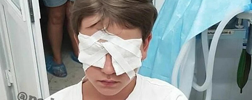 В лагере Невинномысска школьника ослепили ударом мокрого полотенца