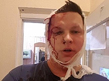 Помощнику депутата проломили голову в Екатеринбурге