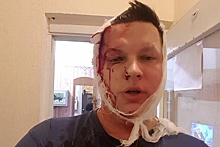 Помощнику депутата проломили голову в Екатеринбурге