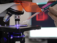 В Китае нашли новый способ лечения болезни Альцгеймера