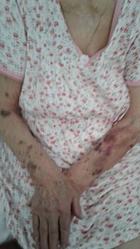 В минздраве Ульяновской области опровергли факт избиения женщины санитаркой в больнице