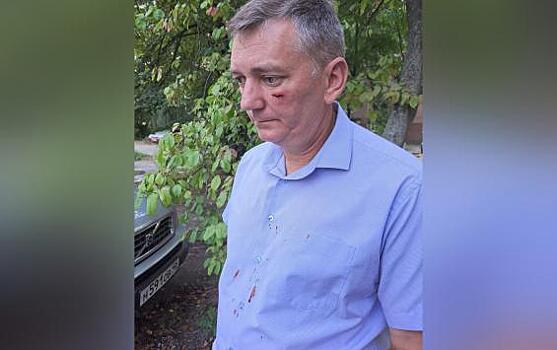 В Курске неизвестный напал на директора УК "Аврора+"