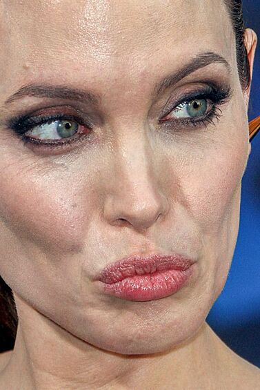 Анджелина Джоли. Из-за слишком низкого веса кожа актрисы потеряла упругость и первые признаки старения стали особенно заметны.